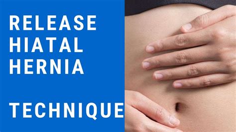 Release Hiatal Hernia And Relieve Gerd Asthma And Heart Palpitation Youtube