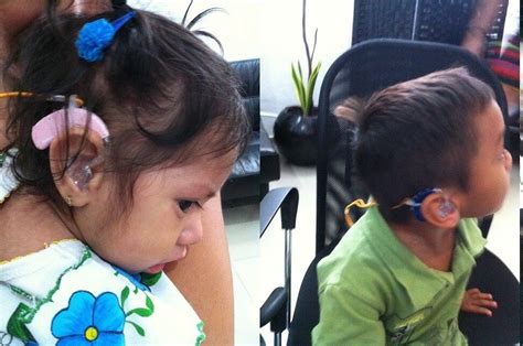 Aparatos Auditivos Hearing Aid Niños Aparato auditivo Niños Auditivo