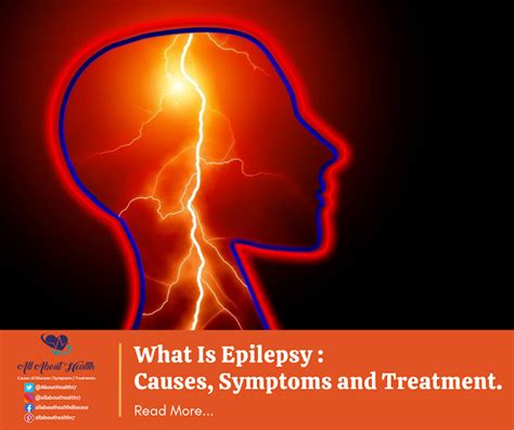 What Is Epilepsy Causes Symptoms And Treatment All About Health