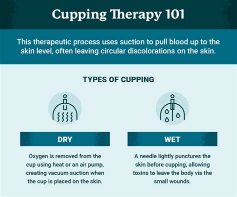 What Is Cupping Therapy Benefits And Applications Usahs