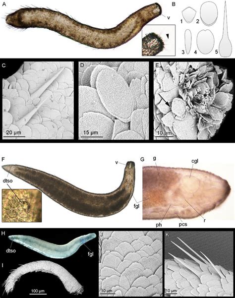 Interstitial Dondersiidae Pholidoskepia Solenogastres From The