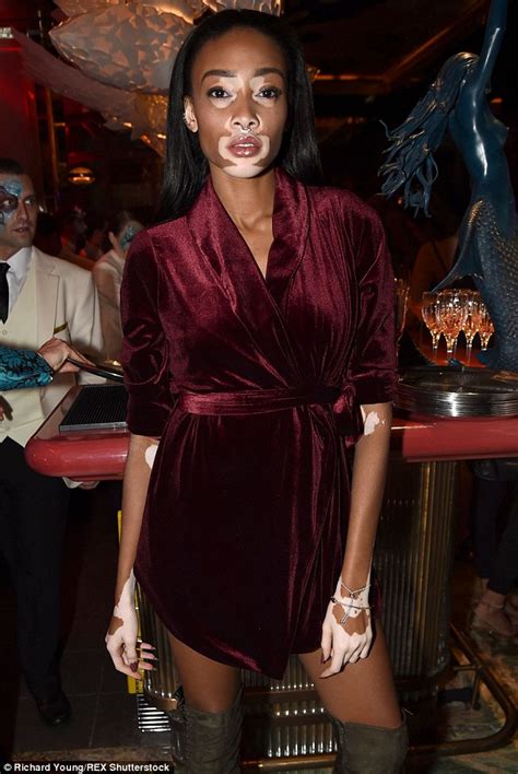 Winnie Harlow Who Suffers From Vitiligo Gives Talk At Women In The