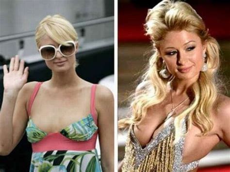 Celebrities Before And After Breast Implants