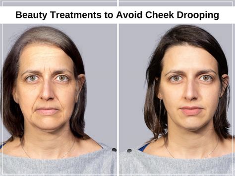 Beauty Treatments To Avoid Drooping Cheeks Usaweeklypress