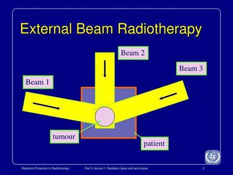 Ppt Radiation Protection In Radiotherapy Powerpoint Presentation
