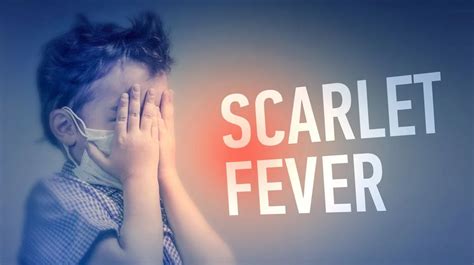 12 Known Scarlet Fever Symptoms Causes Home Remedies And Treatment