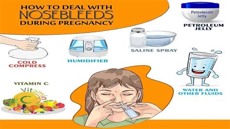 How To Deal With Nosebleeds During Pregnancy Top 10 Home Remedies Youtube