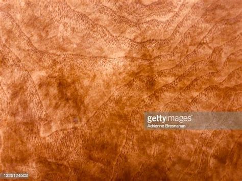 Mottled Skin Photos And Premium High Res Pictures Getty Images