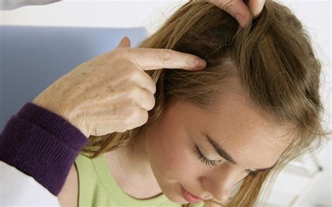 The severity of hair loss can vary from a small area to the entire body. How to use tea tree oil for scalp? 12 best uses