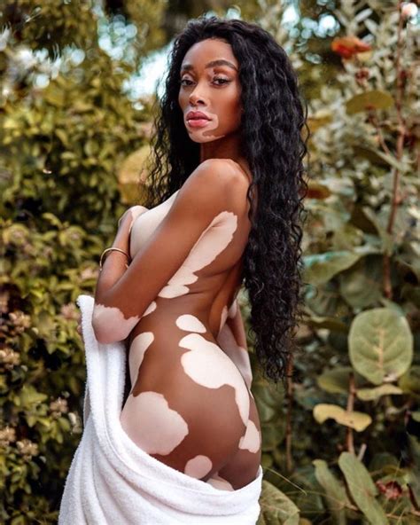 Winnie Harlow Fappening Topless 10 Photos The Fappening