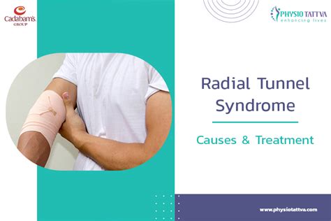 Radial Tunnel Syndrome What Is It Symptoms And Causes