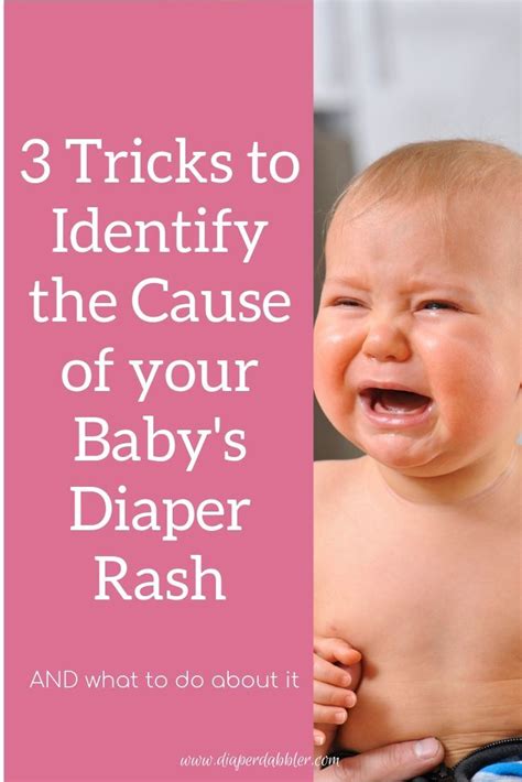 3 Tricks To Identify The Cause Of Your Baby S Diaper Rash Artofit