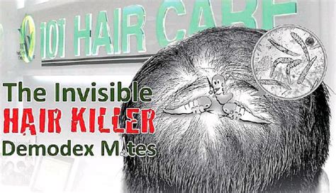 Remove Mites For Healthier Hair Pressreader