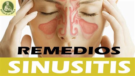 Sinusitis Remedio Natural Remedios Caseros Y Naturales Para La