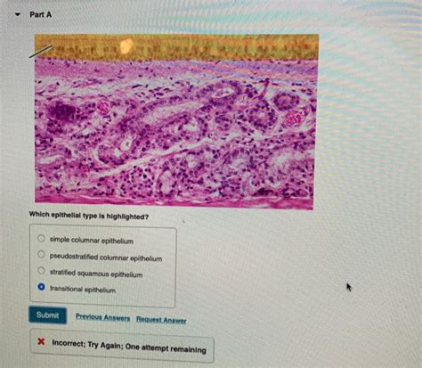 Solved Part A Which Epithelial Type Is Highlighted 0 0 Chegg Com
