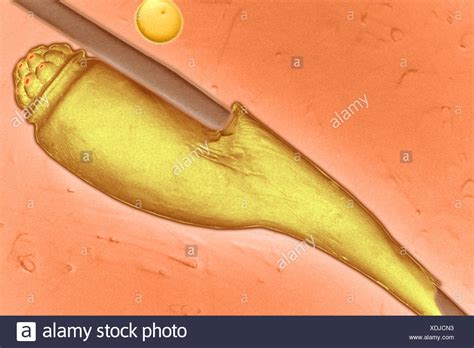 Head Lice Eggs High Resolution Stock Photography And Images Alamy
