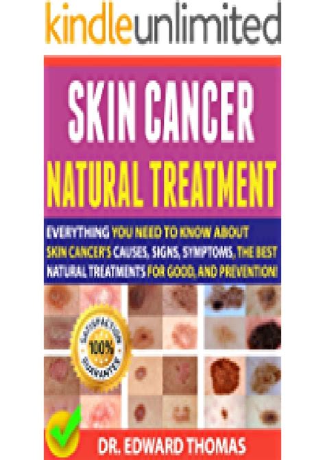 Pdf File Skin Cancer Natural Treatment Everything You Need To