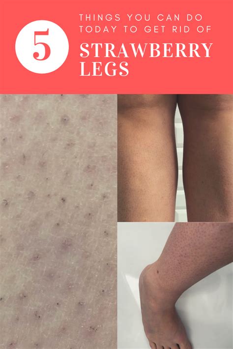 How To Exfoliate Legs With Ingrown Hairs