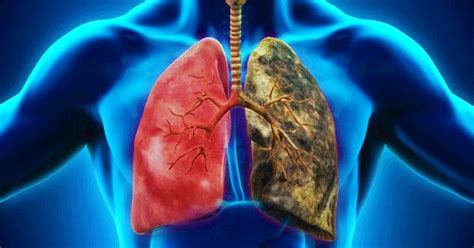 10 Tricks To Keep Your Lungs Strong And Healthy Natural Home Remedies