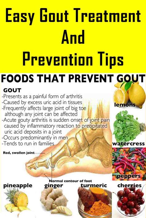 To better predict how long the flu will last, take steps to reduce your risk of contracting the virus and experiencing severe symptoms. Easy Gout Treatment and Prevention Tips: Easy Gout ...