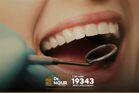 إزالة تصبغات اللثة وتبييض الاسنان بأحدث جهاز ليزر في العالم دكتور نور
