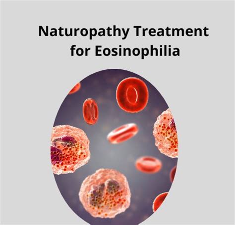 Naturopathy Treatment For Eosinophilia Home Remedies Medintu