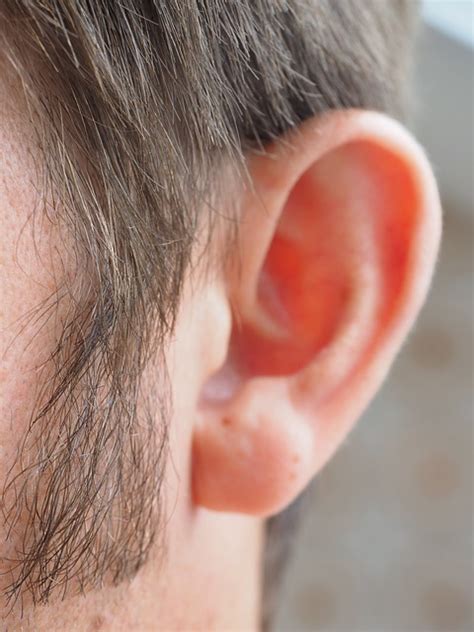 How To Stop Ringing In Ears Doctor Tipster