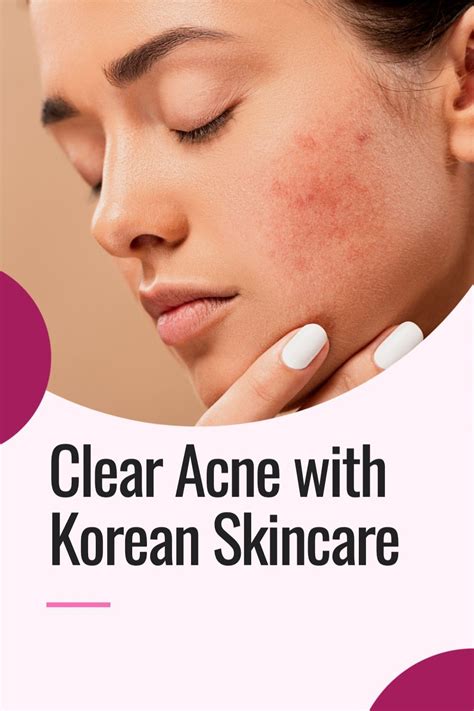 21 Best Korean Skincare Products For Acne That Actually Work