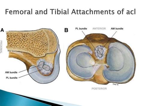 Acl Arthroscopic Reconstruction Single Bundle Vs Double Bundle