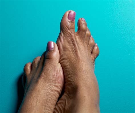 What Causes Feet To Swell Blackdoctor