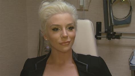 Exclusive Former Teen Bride Courtney Stodden Gets A Nose Job See