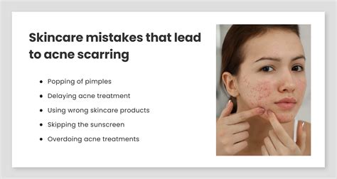 Try These Easy Ways To Remove Acne Scars Reequil