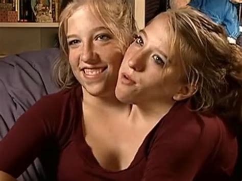 Erwachsene Weibliche Miteinander Verbundene Zwillinge Nackt Zunahme