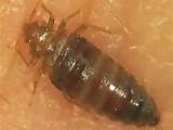 Vinegar To Get Rid Of Bed Bugs Images