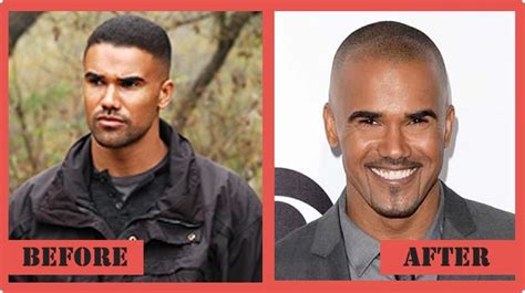 Shemar Moore Plastic Surgery Before And After Photo B12
