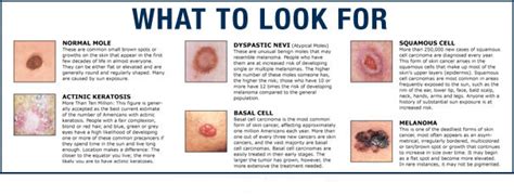 When foot melanoma is diagnosed during its early stages, the cancer is easier to treat. Melanoma Progression - healthandsymptoms