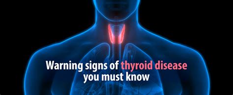 Warning Signs Of Thyroid Disease You Must Know Kdah Blog Health