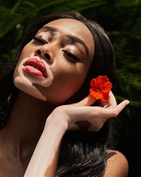 About Winnie Harlow Canada Business And Management Executive Model