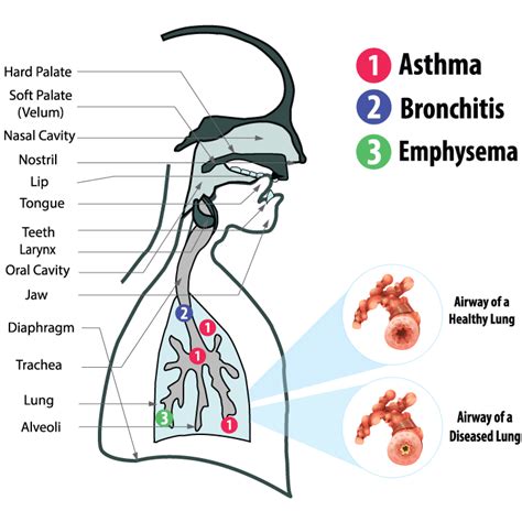 Effect Of Different Respiratory Diseases Affect The Speech Production