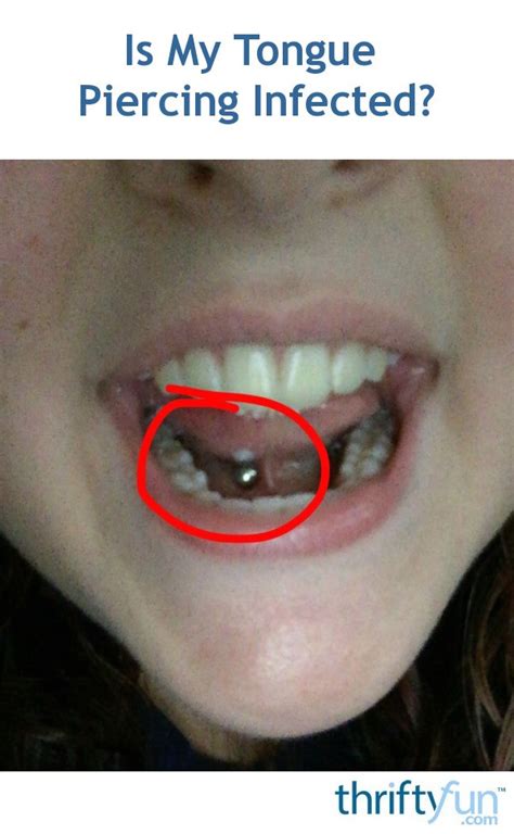 Is My Tongue Piercing Infected Thriftyfun