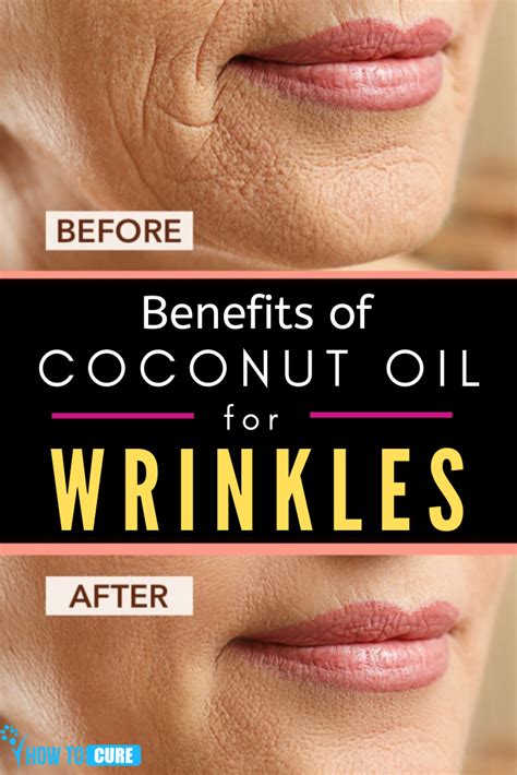 Coconut Oil For Wrinkles Should You Try It In 2020 Skin Care