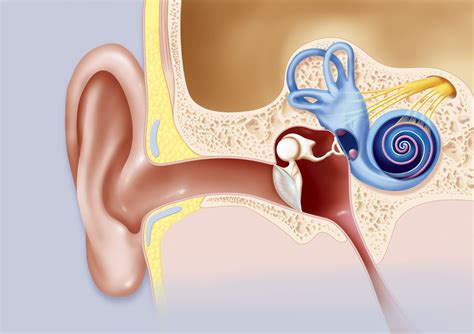 Migraines And Tinnitus Ringing In The Ears