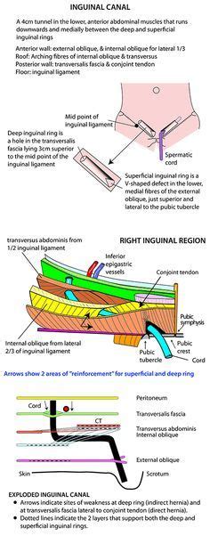 Boundaries of inguinal canal are controversial 5. Anatomy Of Inguinal Canal - Anatomy Drawing Diagram