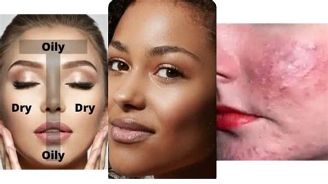 How To Know Your Skin Type And How To Take Care Of Oily Skin Momedia