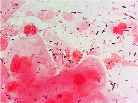 Filebacteria Gram Stained Vaginal Smear 09 Embryology