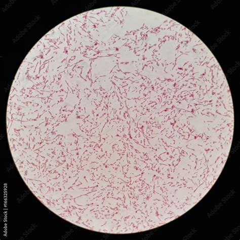 Smear Of Gram Negative Bacilli Bacteria Under 100x Light Microscope