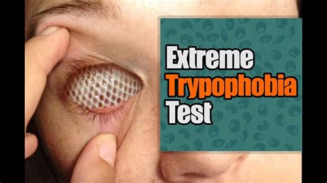 Pin On Extreme Trypophobia Test I How To Test Your Bd107
