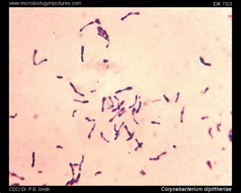 Corynebacterium Diphtheriae Stained Using The Methylene Blue Technique
