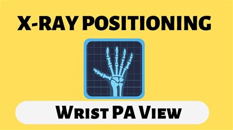 Wrist Pa View X Ray Positioning For Radiographers Doctor Inside