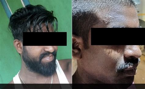 Dalit Man Tortured His Head Shaved By Andhra Policemen Three Cops